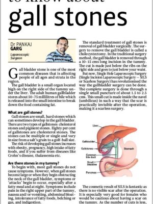 Daily Post (National Edition)- Feb 14, 2012-.All that you wanted to know about Gall Stones