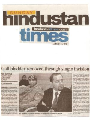 Hindustan Times- 17 Jan, 2010-Gall Bladder removed through a single incision for the First time in North Region